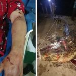 Kolase tangan korban bekas gigitan buaya dan bangkai buaya yang berhasil ditangkap warga.