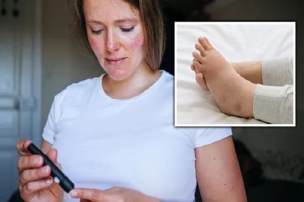gejala-diabetes-tipe-2-kaki-bengkak-tanda-gula-darah-tinggi-cam